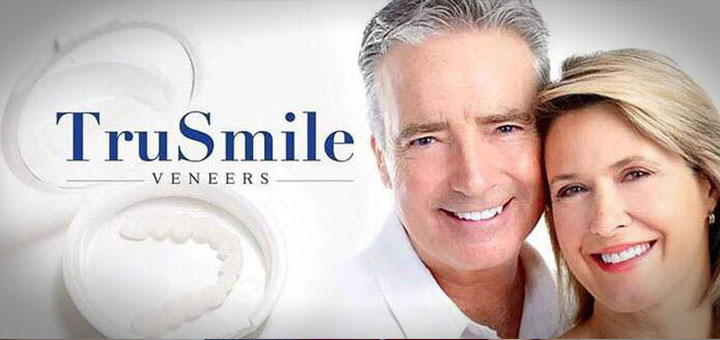 خرید لمینت متحرک دندان tru smile
